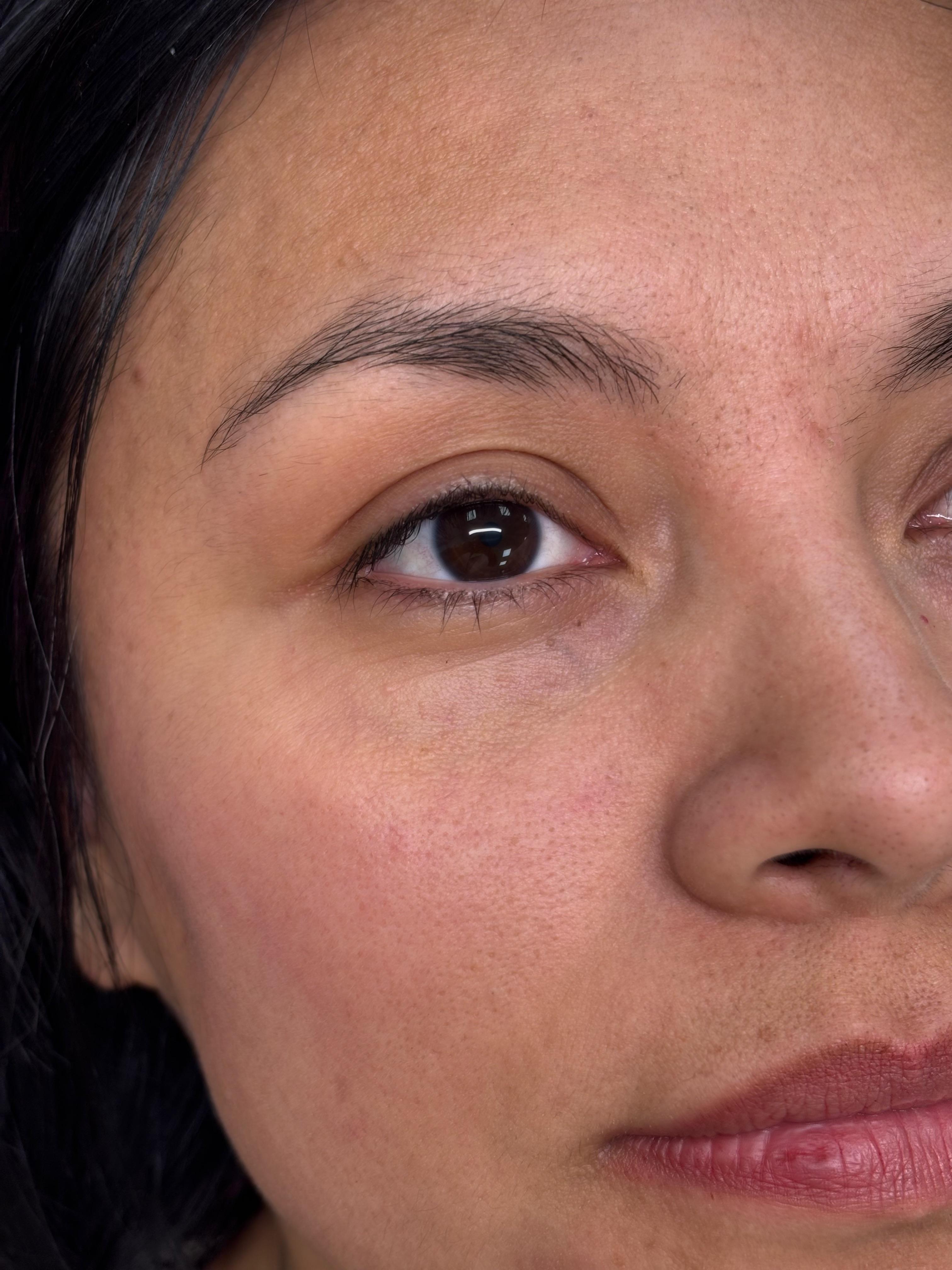 Korean Lash Lift — Before